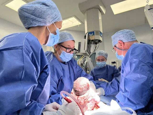 تولد نوزاد با رحم پیوندی از اهدا کننده متوفی