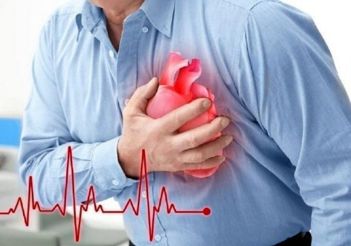 کاهش سن بروز سکته قلبی در کشور؛ خطر در کمین ۳۰ تا ۴۰ ساله‌ها