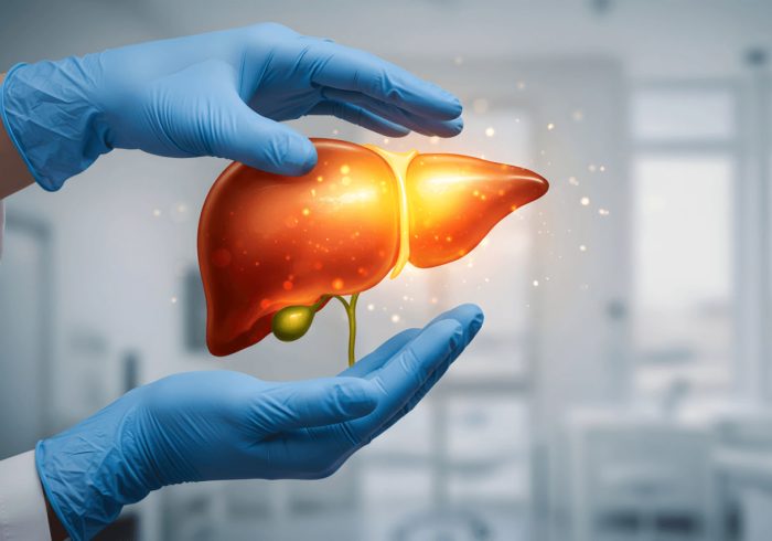 کبد چرب؛ آزمایشها و رژیم غذایی کبد چرب؛ آزمایشها و رژیم غذایی