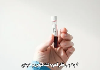 کم‌خونی فقر آهن؛ تشخیص و درمان