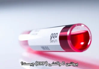 پروتئین C واکنشی (CRP) چیست؟