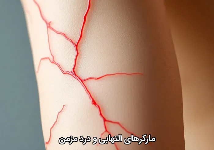 مارکرهای التهابی و درد مزمن مارکرهای التهابی و درد مزمن